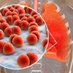 Swiss Biotech Halts Pneumonia Antibiotic Trial After Patient Safety Scare